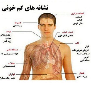 کم خونی فقر آهن و مشکلات همراه با آن