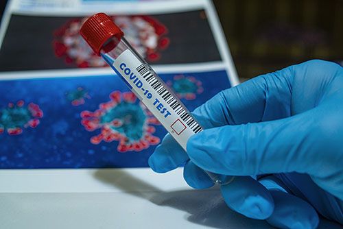 آزمایش ویروس کرونا